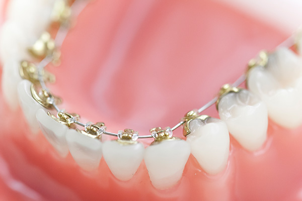 Dr. Marcus Rönnebeck - Kieferorthopäde (Lingualtechnik) für Erwachsene in Reutlingen 